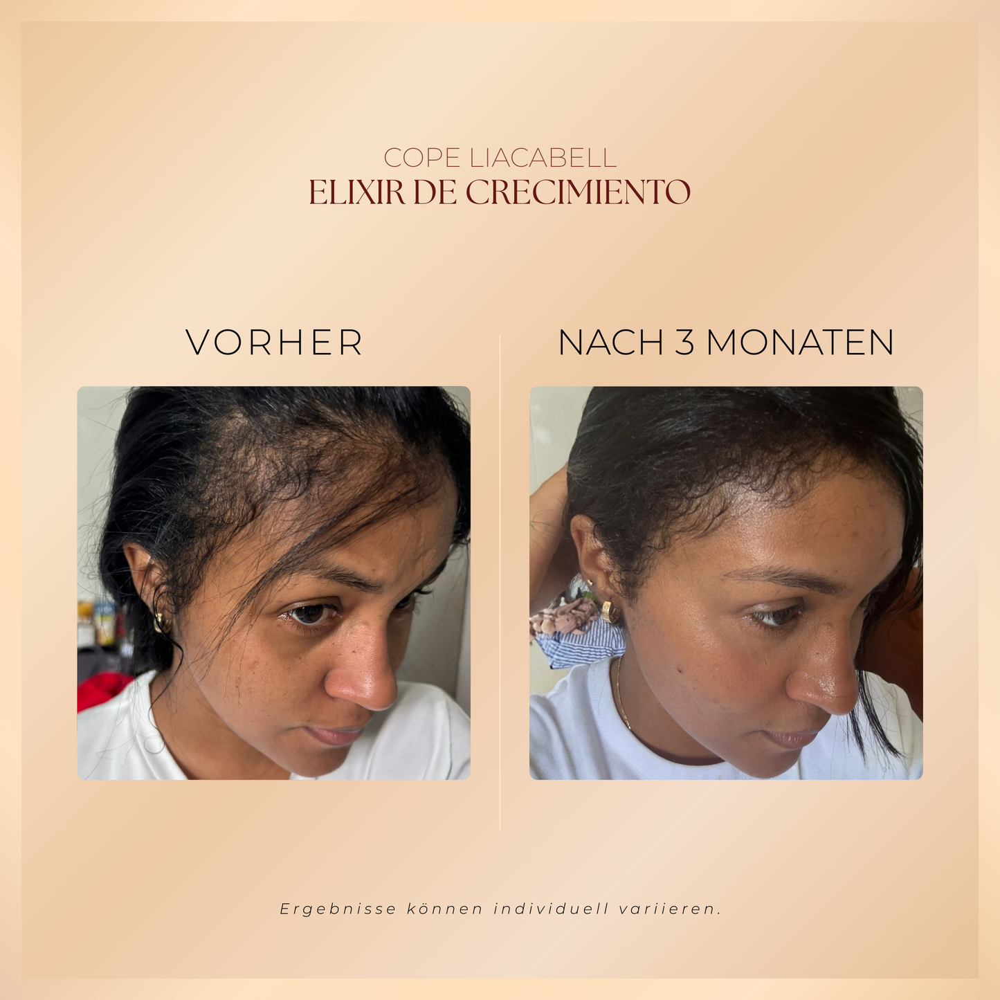 Elixir de Crecimiento